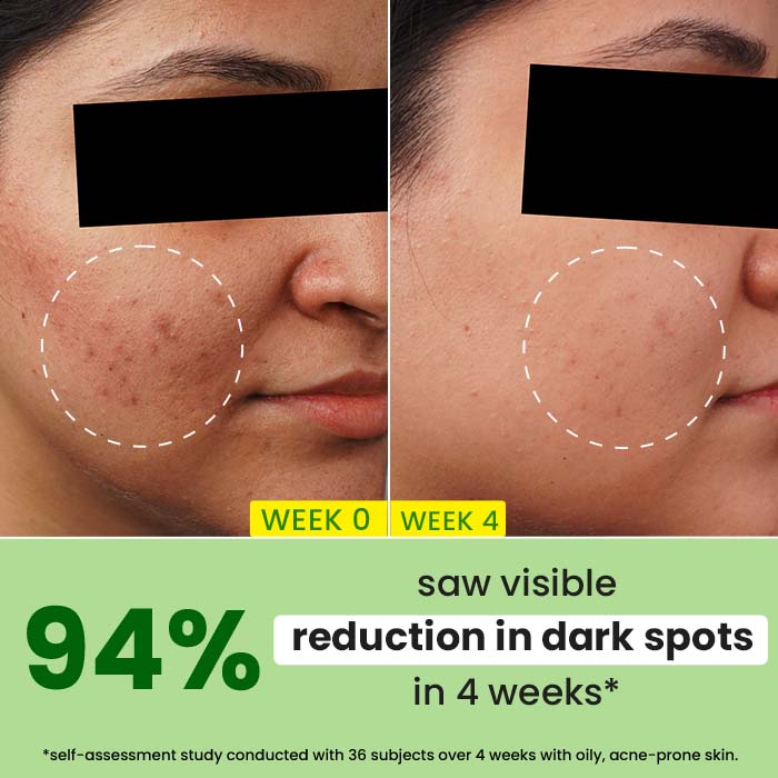Cica + 10% Niacinamide Face Serum for Oily Skin - Image 3