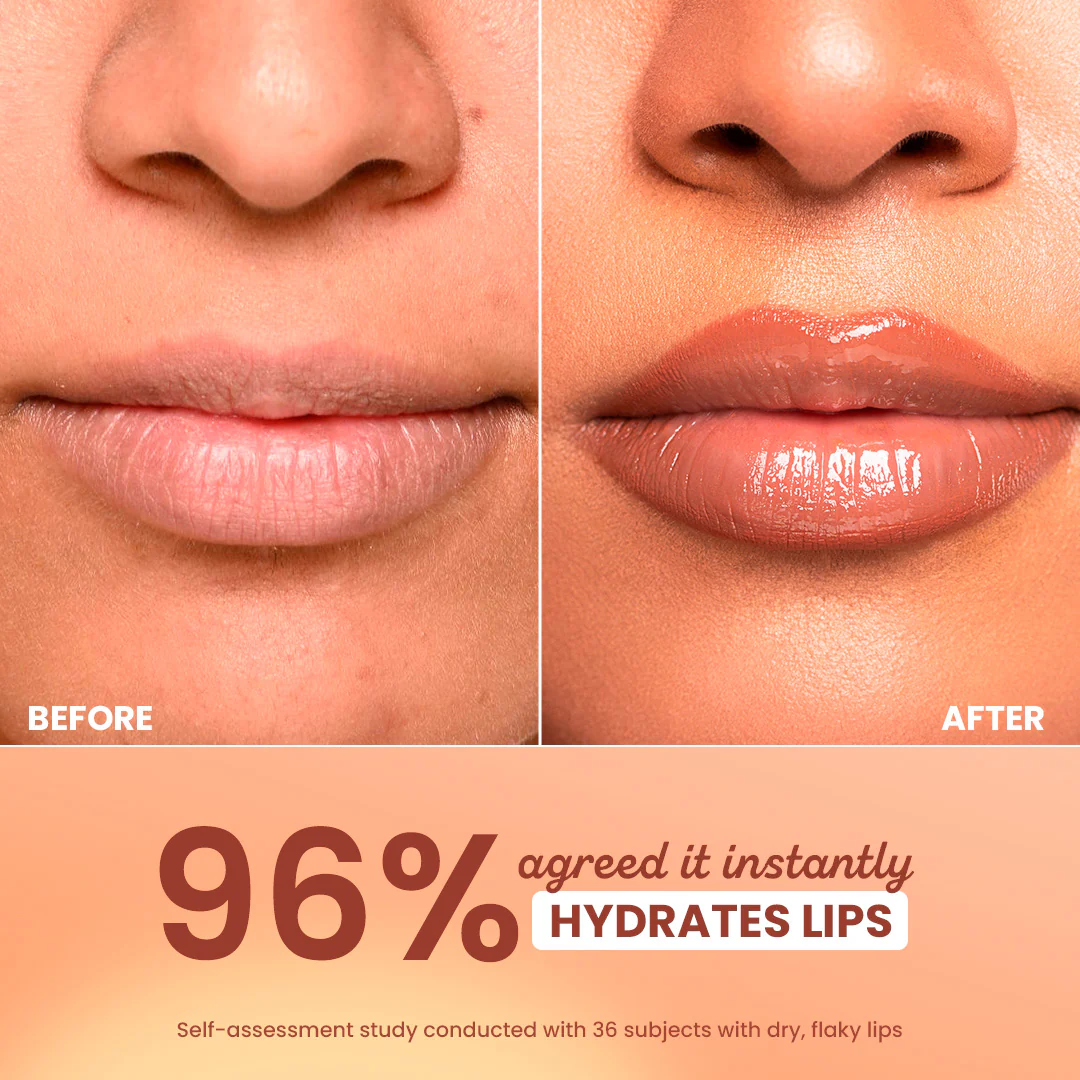 Barrier Repair Hydrating Lip Balm In-Vivo Tested SPF 50+ PA+++ - Image 23