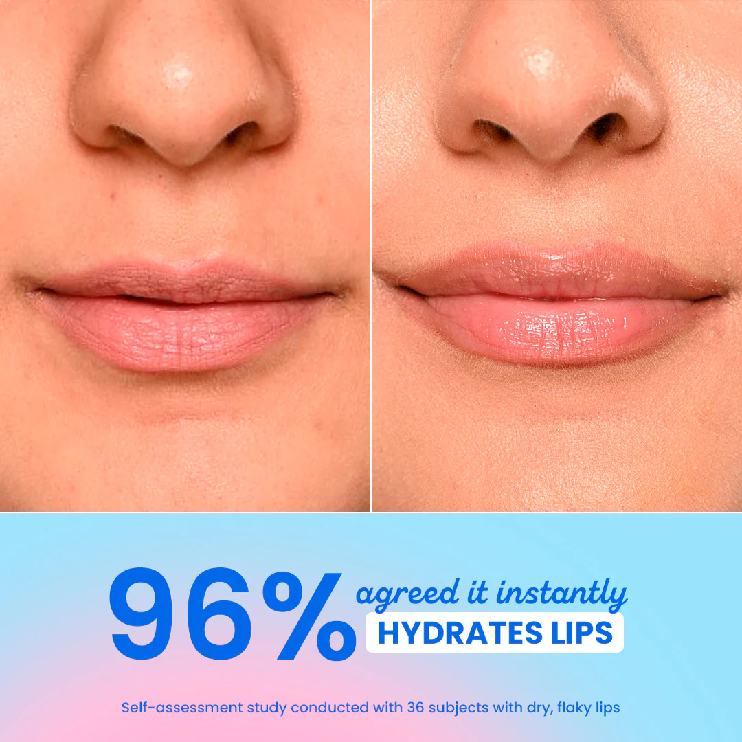 Barrier Repair Hydrating Lip Balm In-Vivo Tested SPF 50+ PA+++ - Image 30