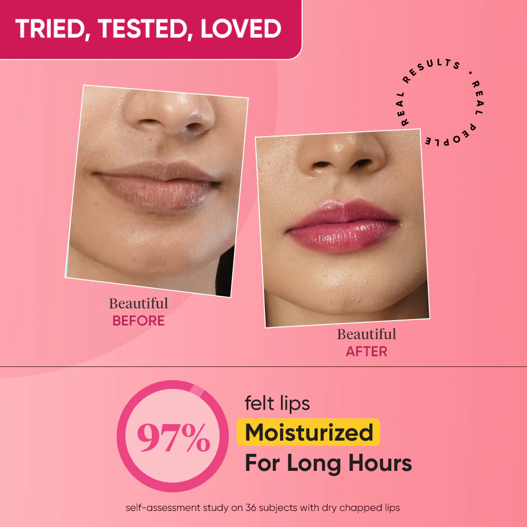 Vitamin C + E Gloss Boss Lip Balm In-Vivo Tested SPF 50+ PA+++ - Image 14