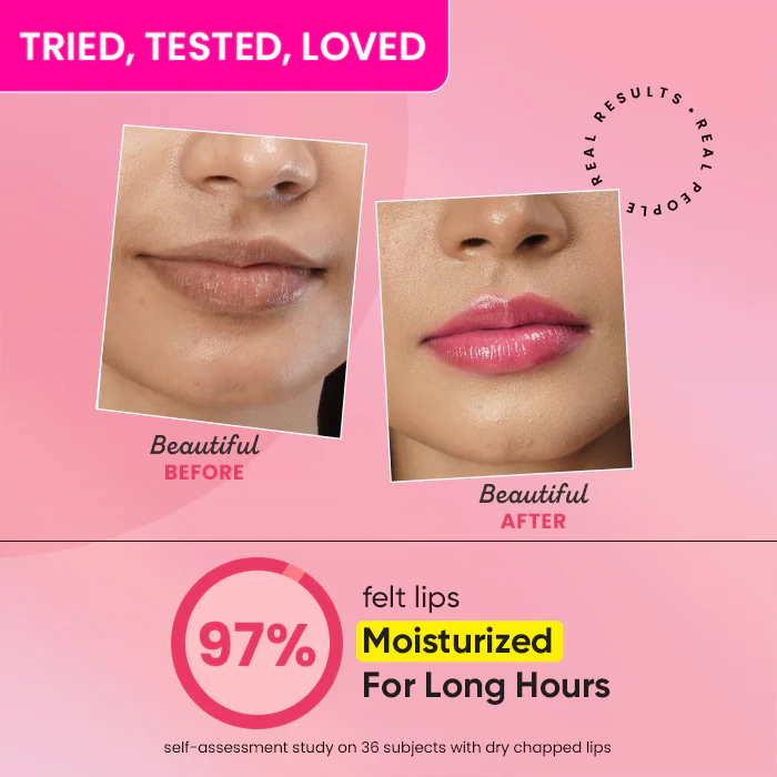 Vitamin C + E Gloss Boss Lip Balm In-Vivo Tested SPF 50+ PA+++ - Image 23