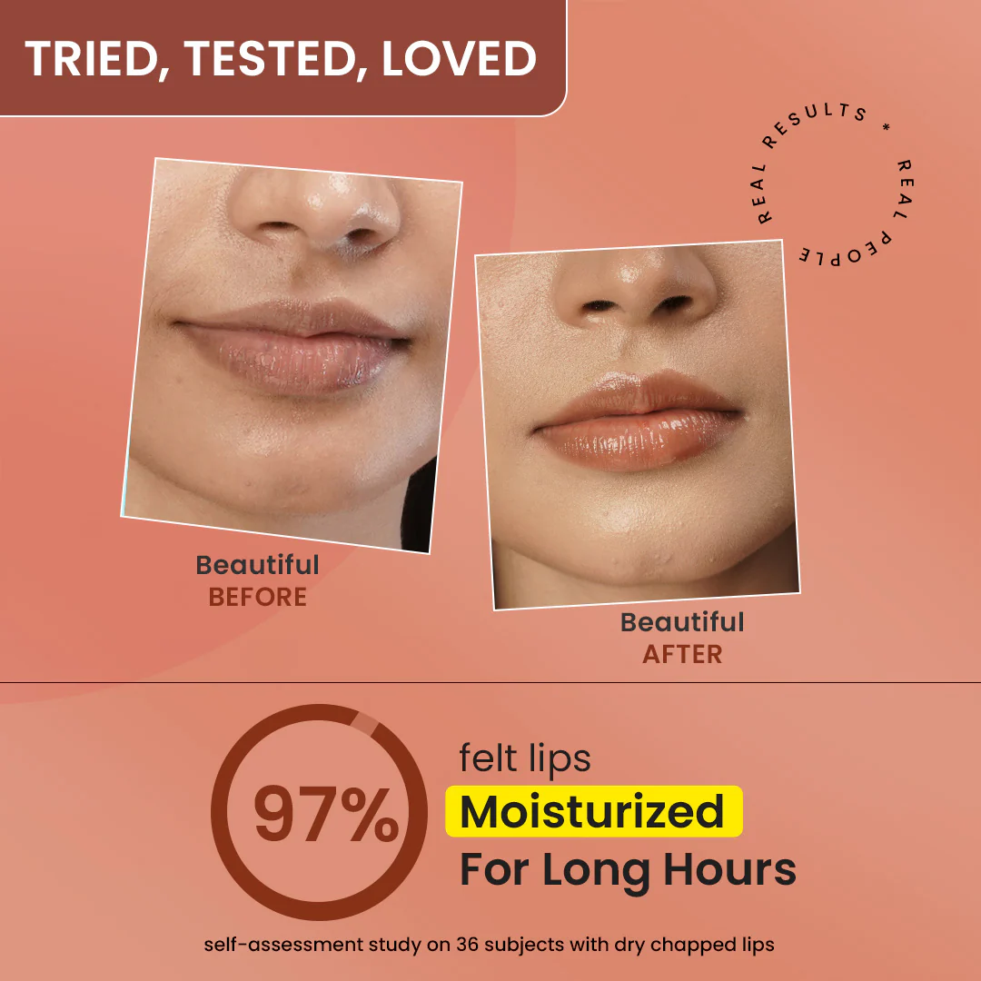 Vitamin C + E Gloss Boss Lip Balm In-Vivo Tested SPF 50+ PA+++ - Image 32