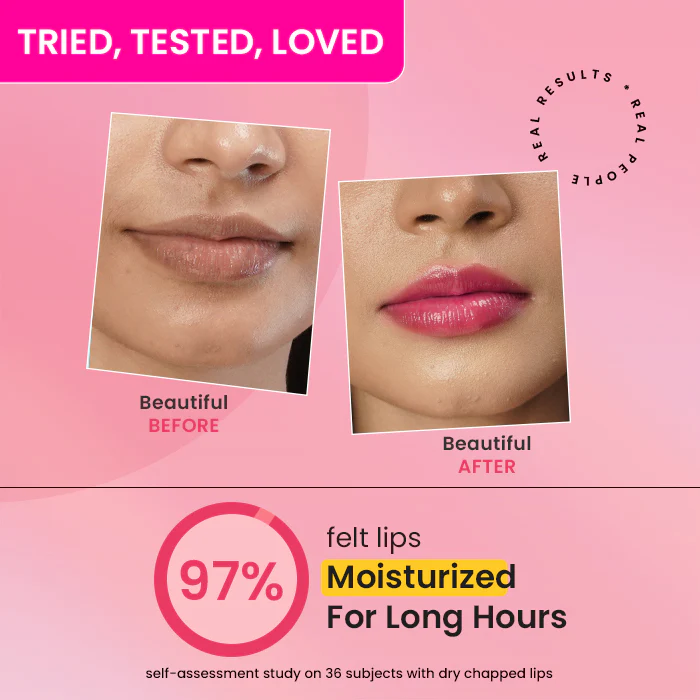 Vitamin C + E Gloss Boss Lip Balm In-Vivo Tested SPF 50+ PA+++ - Image 41