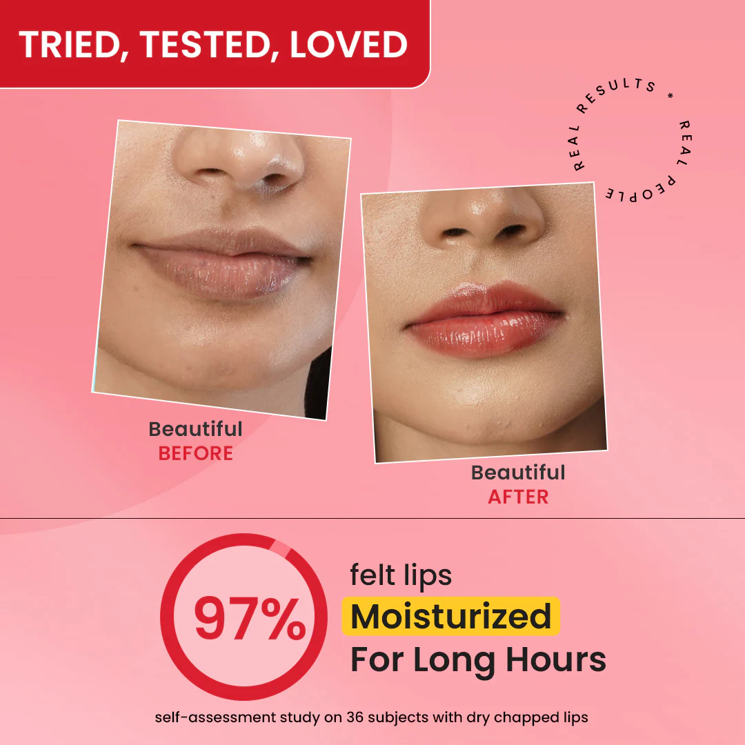 Vitamin C + E Gloss Boss Lip Balm In-Vivo Tested SPF 50+ PA+++ - Image 5