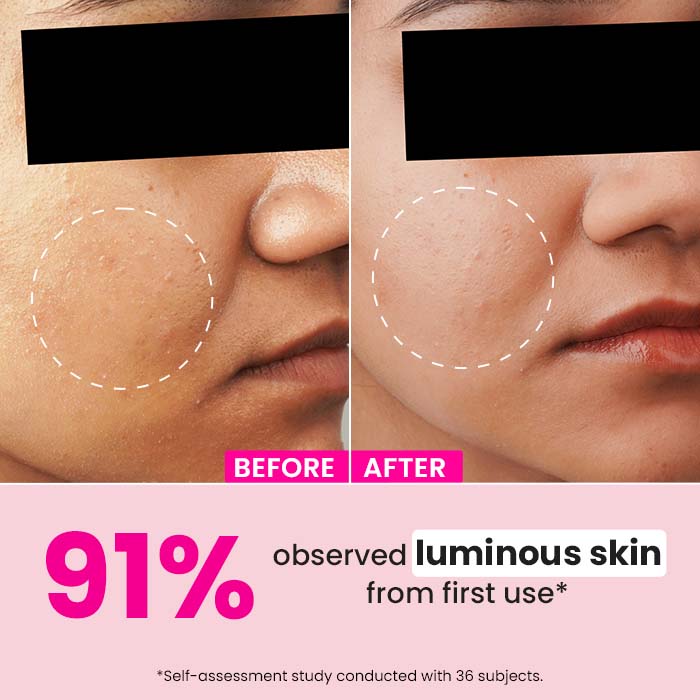 Watermelon & 10% Glycolic Serum - Image 3